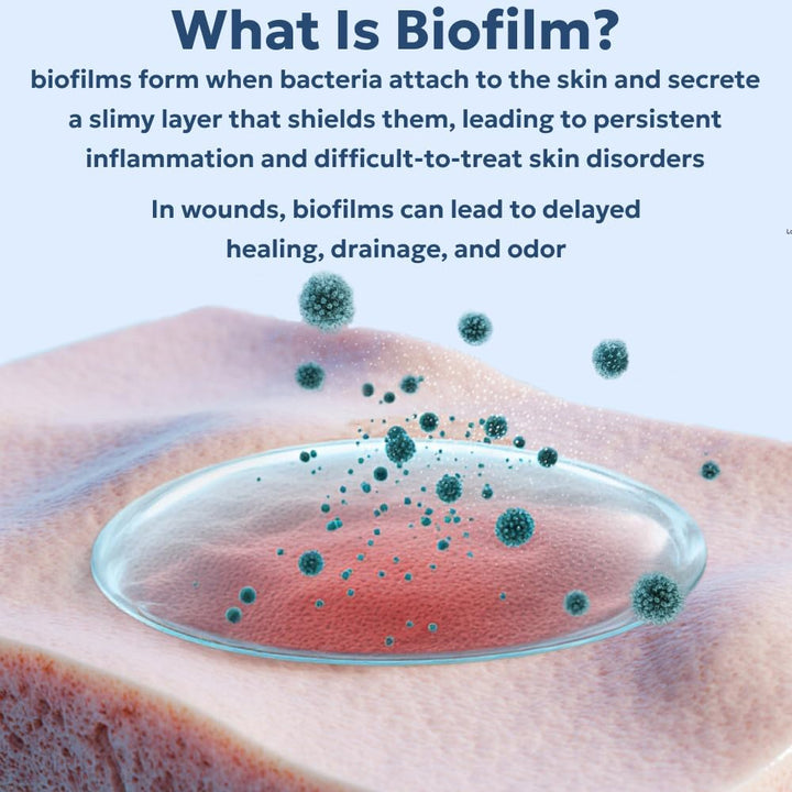 Blue Butter – Hot Spot Treatment for Dogs | Dog Wound Care | Skin Yeast Infections, Ringworm, Cuts, Rashes, First Aid Veterinary Strength Topical Ointment 4Oz