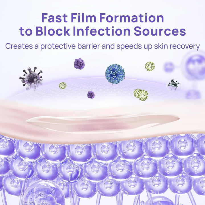 Dog Wound Care Hydro Gel, Heals Wounds, Hot Spot Treatment for Dogs, Soothes Inflammation, Prevents Infection, Treats Bites, Scratches & Skin Ulcers, Cat Wound Care Solution, 3.4 Ounces